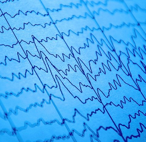 PEM Corporate finance management